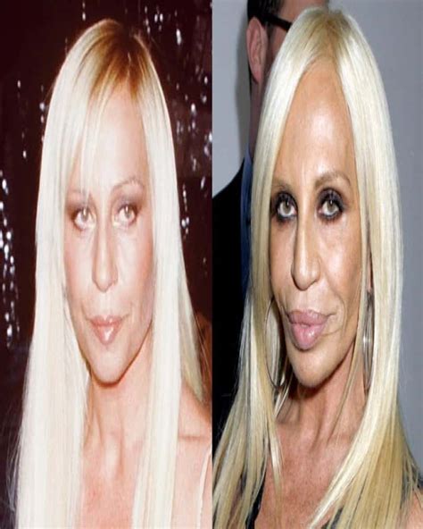 20 Celebrity Plastic Surgery Disasters